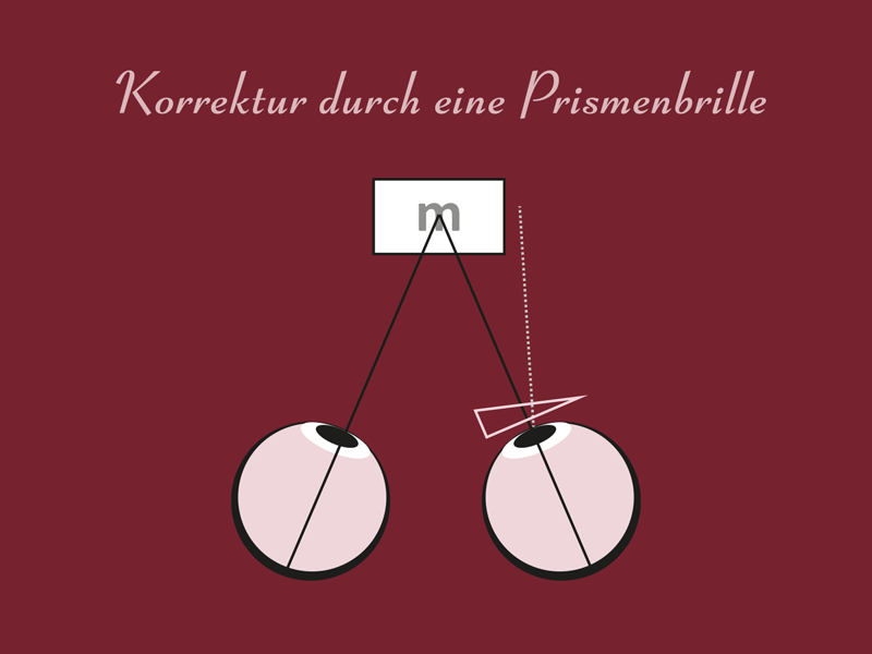 Was sind Prismenbrillen Prismenbrille
